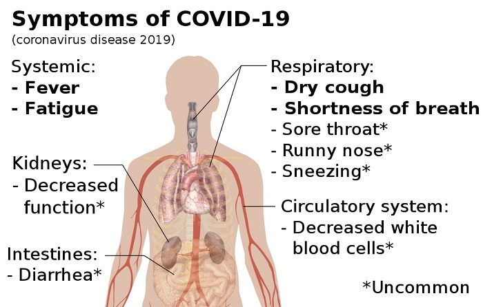 Severe Covid symptoms will be faced by 20 percent of population