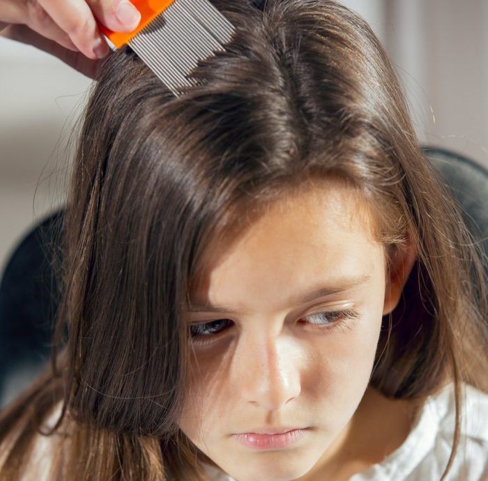 Irritated about lice? Here are some home remedies to get rid of lice