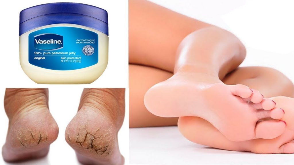 vaseline and socks for dry feet