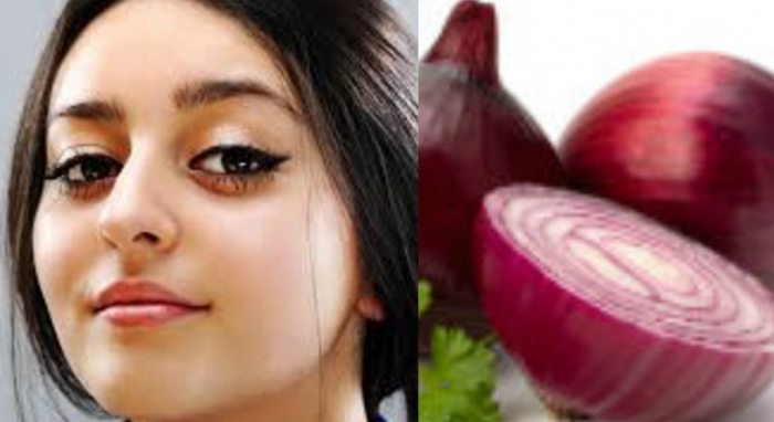 Get Rid Of Dark Spots With An Onion Juice Mask Uae24x7 dark spots with an onion juice mask