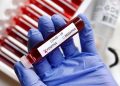 Coronavirus: Abu Dhabi tests up to 10,000 swabs from around the planet consistently