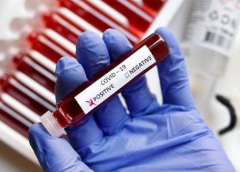 Coronavirus: Abu Dhabi tests up to 10,000 swabs from around the planet consistently