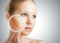 3 magic masks to get rid of winter skin problems